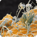 Bacteria & Fungi
